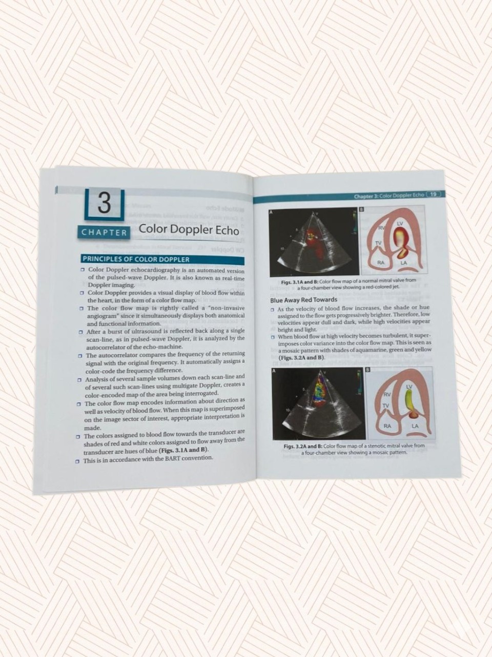 Luthra's ECHO Made Easy 