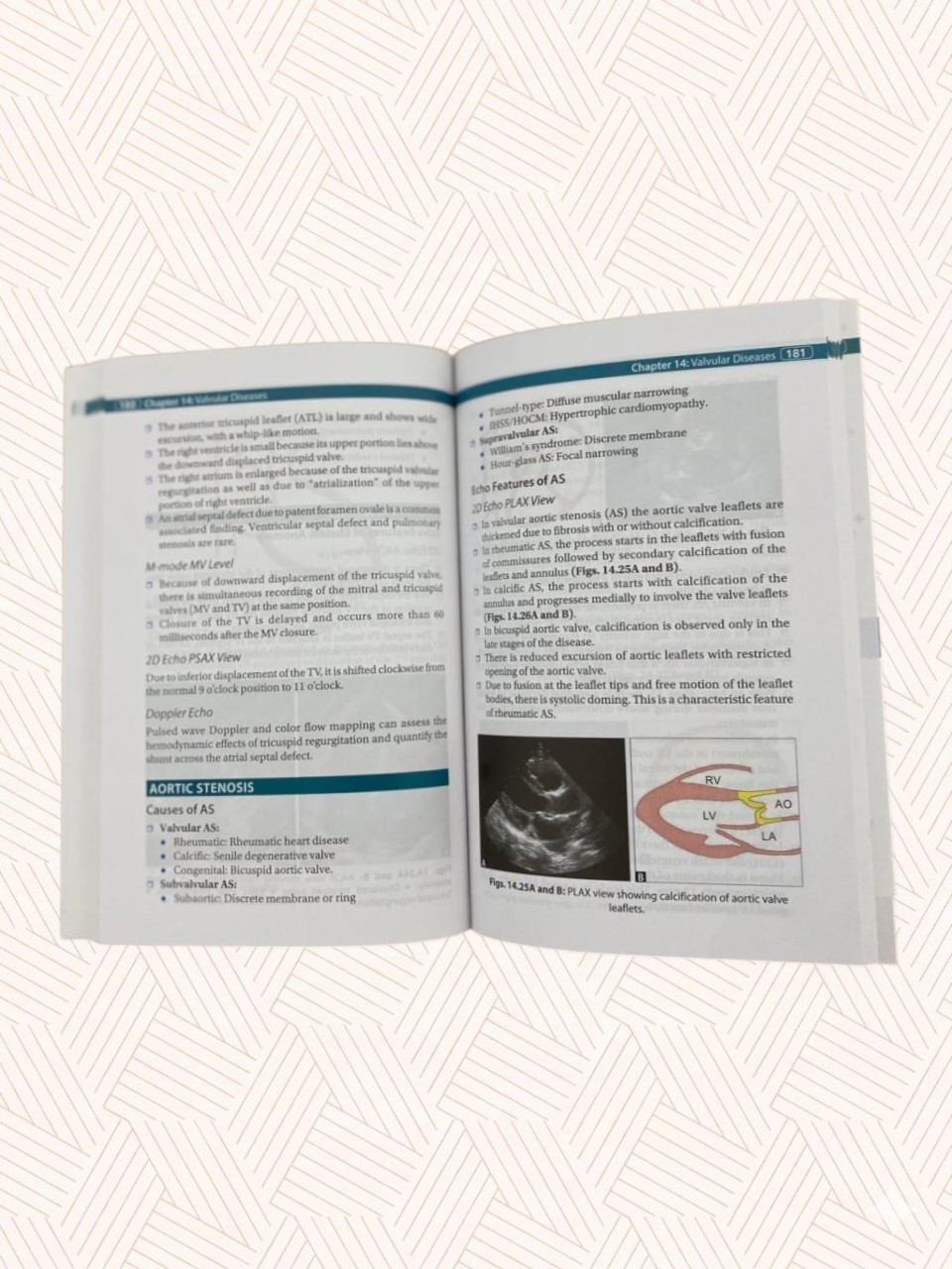 Luthra's ECHO Made Easy 